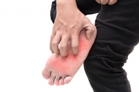 Where Does The Fungus That Causes Athlete’s Foot Live?