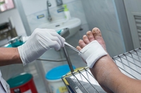 Why Diabetic Foot Ulcers Are Problematic